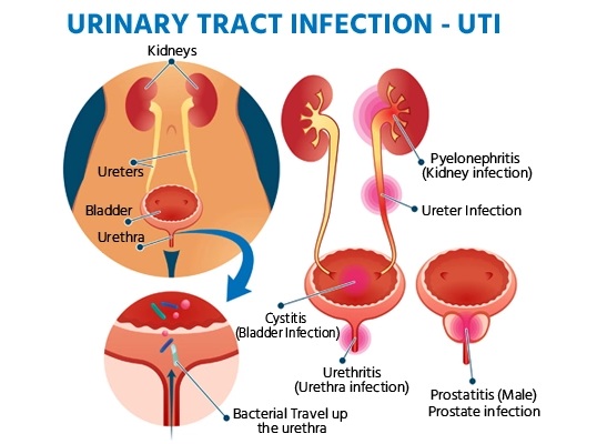 utttt1