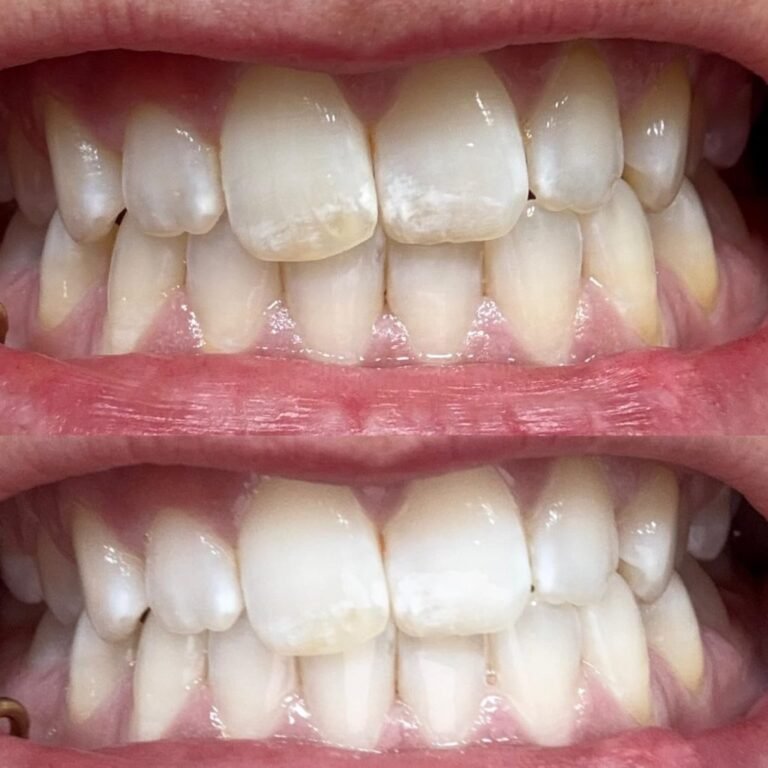 71kfJ1TEZRL-1024x1024